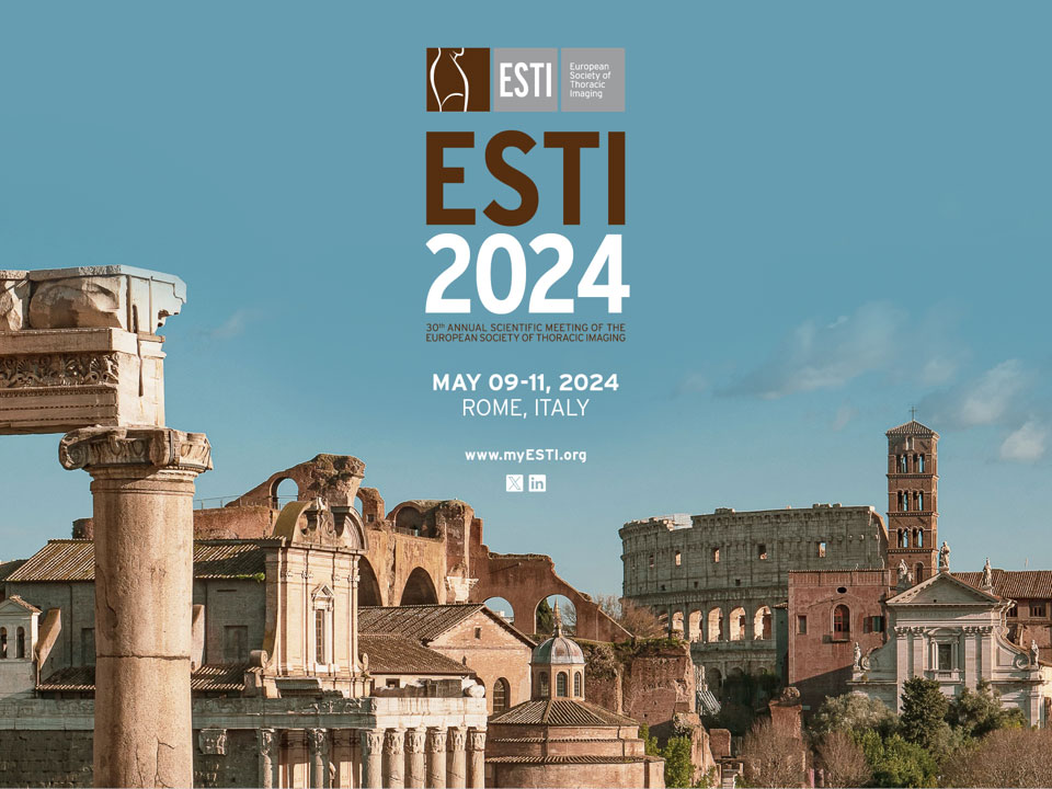 Esti news