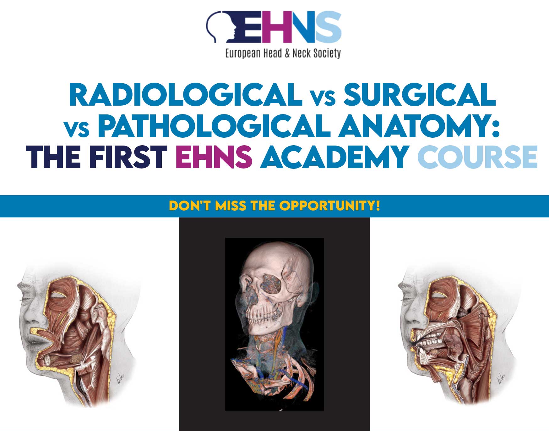 EHNS