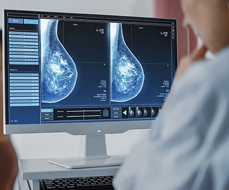 tumore al seno medium 1