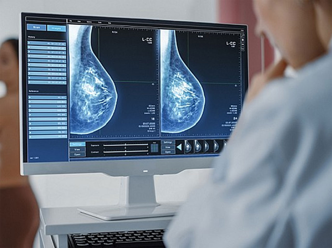 tumore al seno medium 1