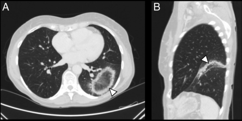 SIRM Insight - Febbraio 2026 1 1